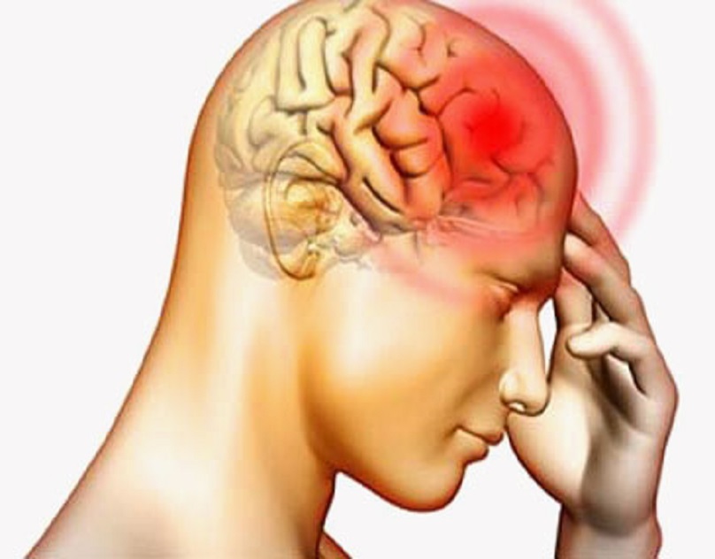 cerebrovascular-disease-treatment-by-dr-vikas-kathuria-neurology