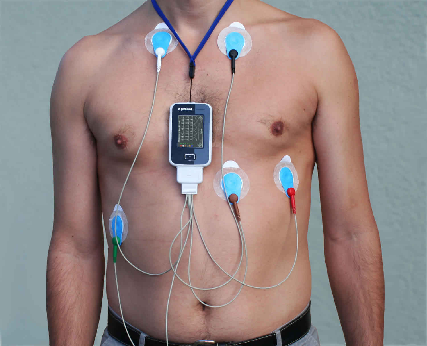 Holter And Event Monitor What Are They Used For Cardiology Mediniz